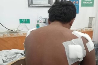 korban serangan buaya di kedindingan saat di rawat di rumah sakit. (istimewa)